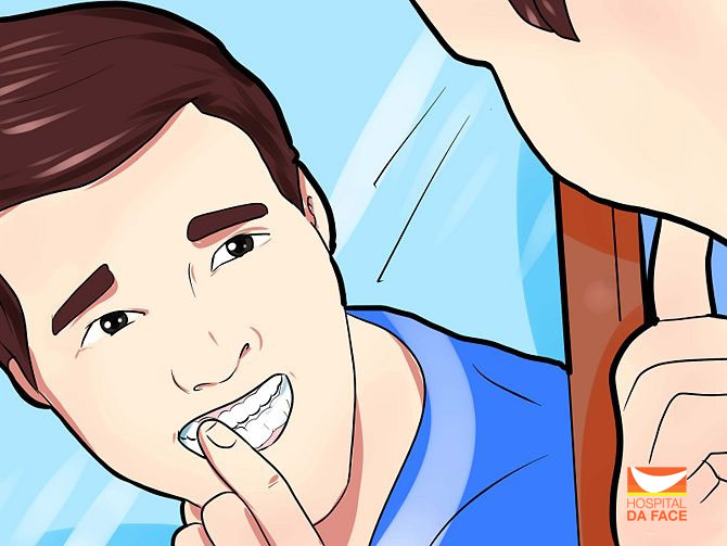 Diferenças entre aparelhos móveis e fixos