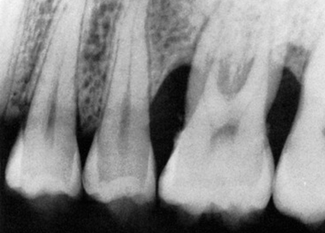 Tratamento periodontoal com qualidade é na Velasco odontologia