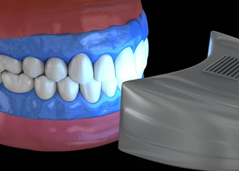 Clareamento dentário com especialistas na Velasco odontologia