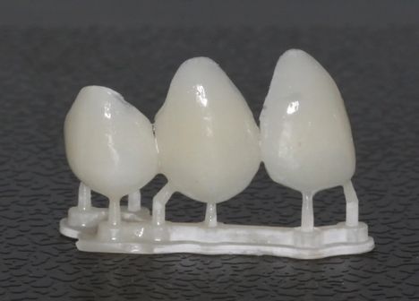 Lentes de resina com especialistas é na Velasco odontologia 