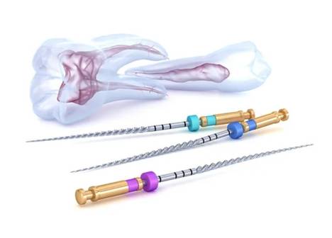 tratamento de canal é na Odontologia Velasco 