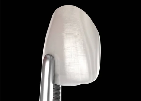 Lentes de contato em porcelana com especialistas é na Velasco Odontologia