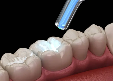 Restaurações estéticas com especialistas na Velasco odontologia