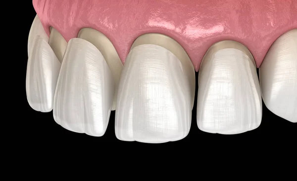 Tratamentos estéticos dentários com especialistas é na Velasco odontologia