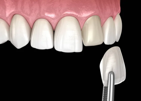 Lentes de contato com especialistas é na Velasco Odontologia