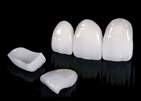 Lentes de porcelana com especialistas é na Velasco odontologia 