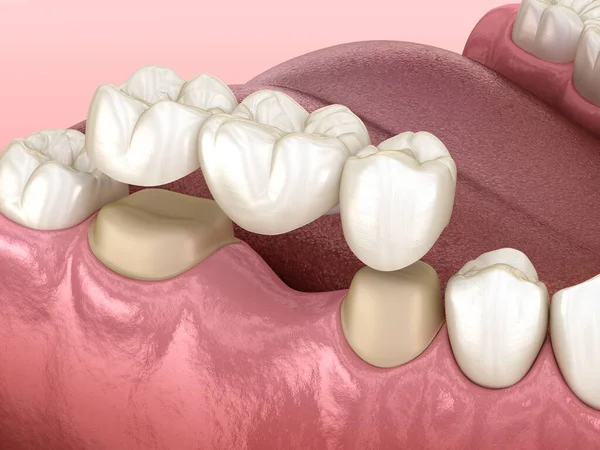 Prótese dentária com especialistas é na Velasco odontologia 