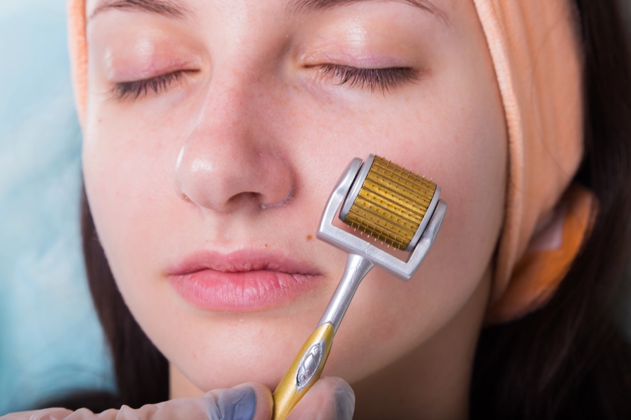 Quando devo extrair um dente para colocar um implante?